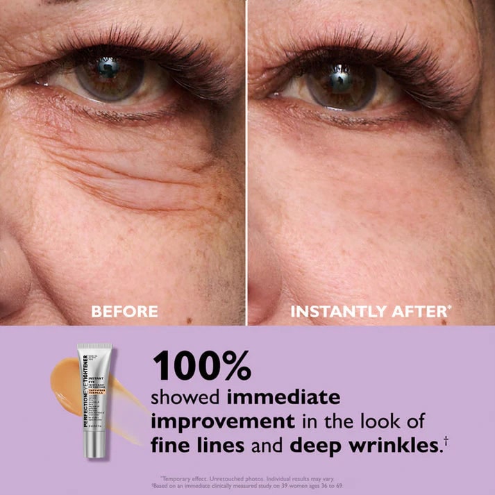 Dark Circle Eye Cream Cream Eye Cream for Dark Circles - Image 3
