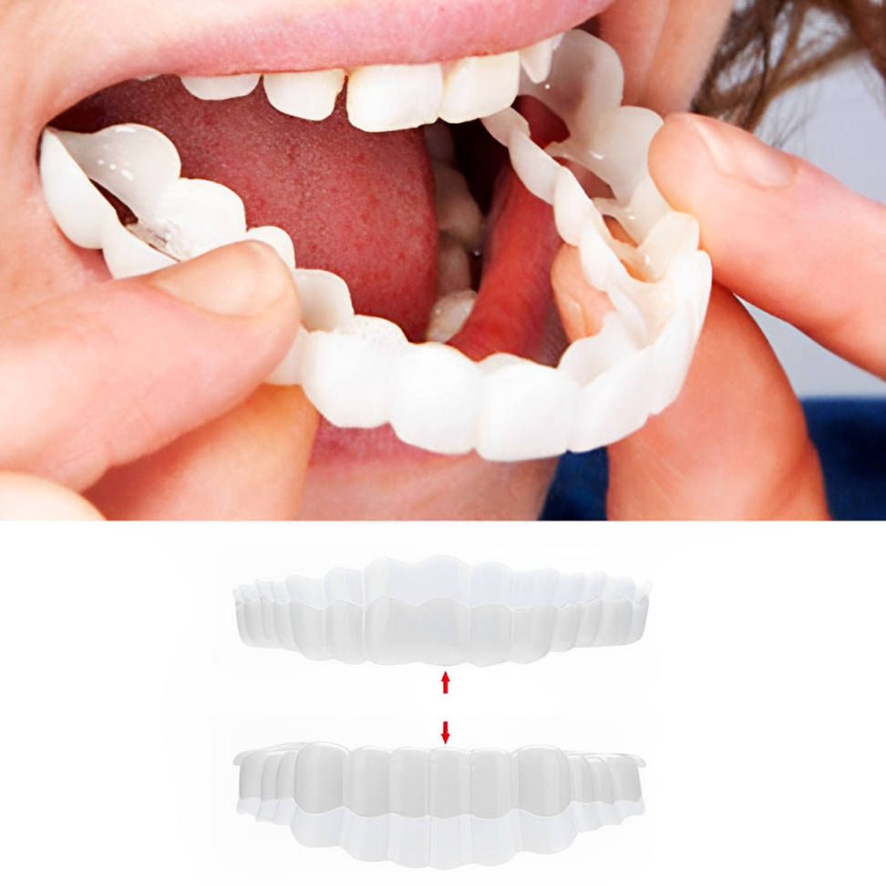 on Veneers Clip on Veneers Teeth Cover Temporary Smile White - Image 1