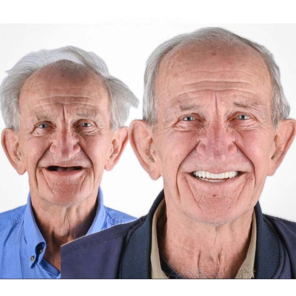 Removable Dentures With Flexible Cushion Grip Full Arch Set For Comfortable Daily Wear - Image 12