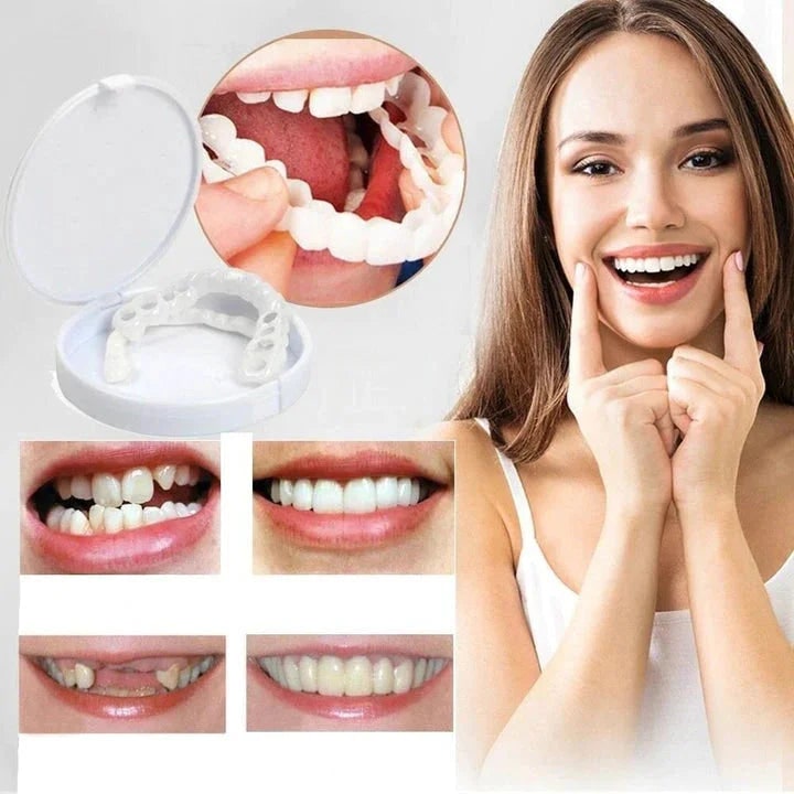 Snap On Veneers For A Natural Smile Correction Instantly - Image 2