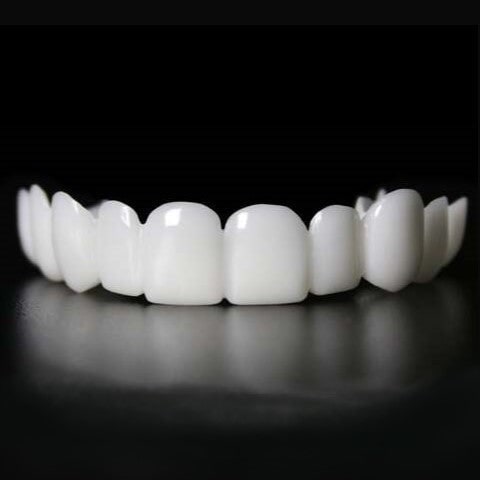 Snap On Veneers For A Natural Smile Correction Instantly - Image 3